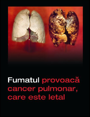 Romania 2008 Health Effects lung - diseased organ, lung cancer, gross, Romanian